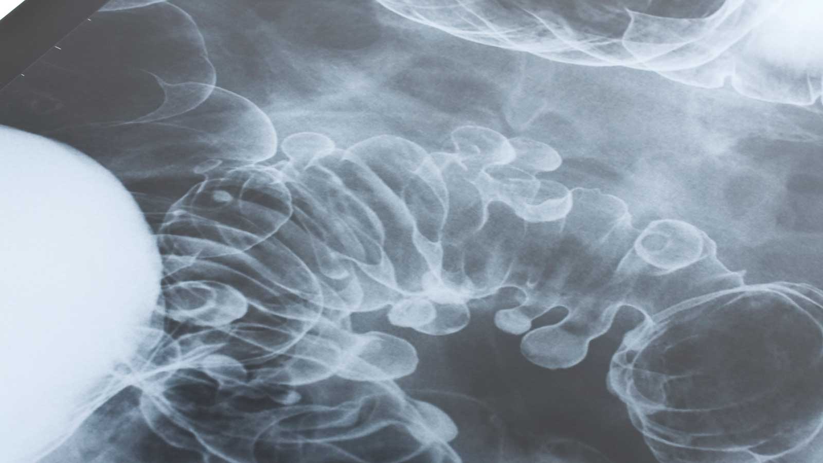 Evidence-based quality in radiographic imaging | Metropolia UAS